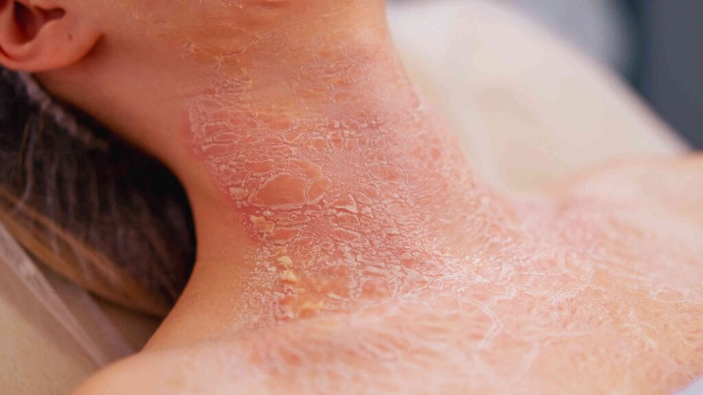 best body moisturizer for dry skin