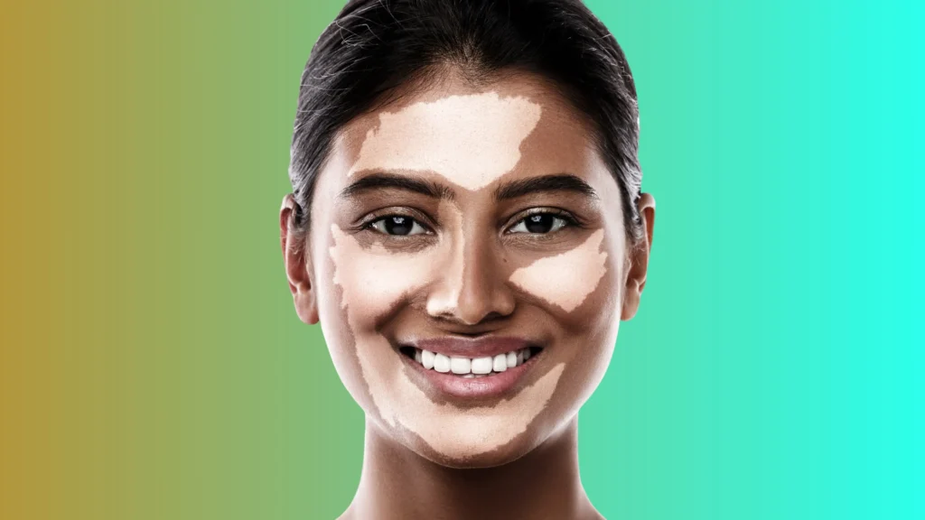 What Makes Combination Skin Care Different